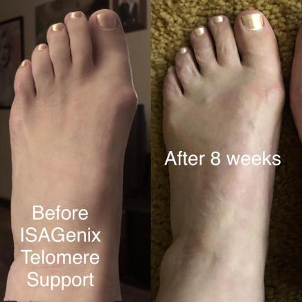 foot example anita